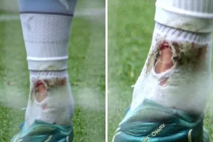 Haaland's ankle